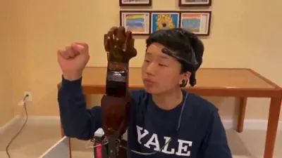 Student Engineer Builds $300 Prosthetic That Rivals Elite Systems.