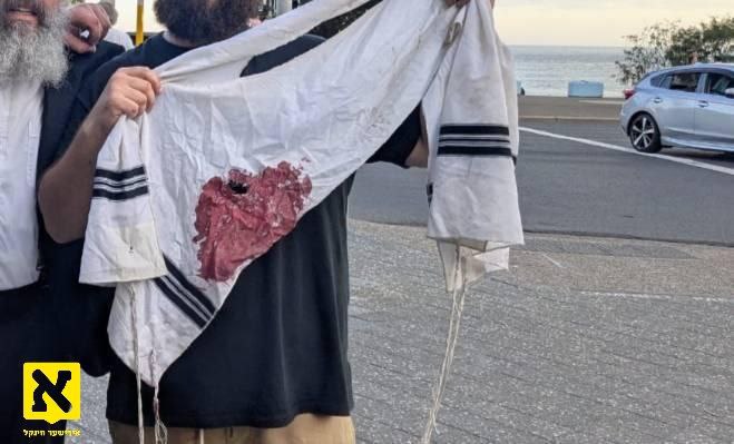 הארצרייסנד און אומפארגעבליך. 

א ציצית, געלעכערט פ